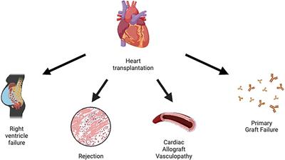 Heart transplantation and biomarkers: a review about their usefulness in clinical practice